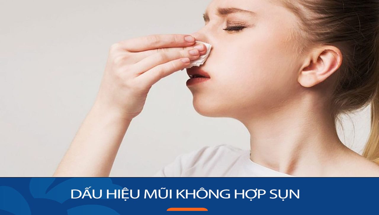 Những dấu hiệu mũi không hợp sụn, Kiến thức KH Việt Kiều cần biết