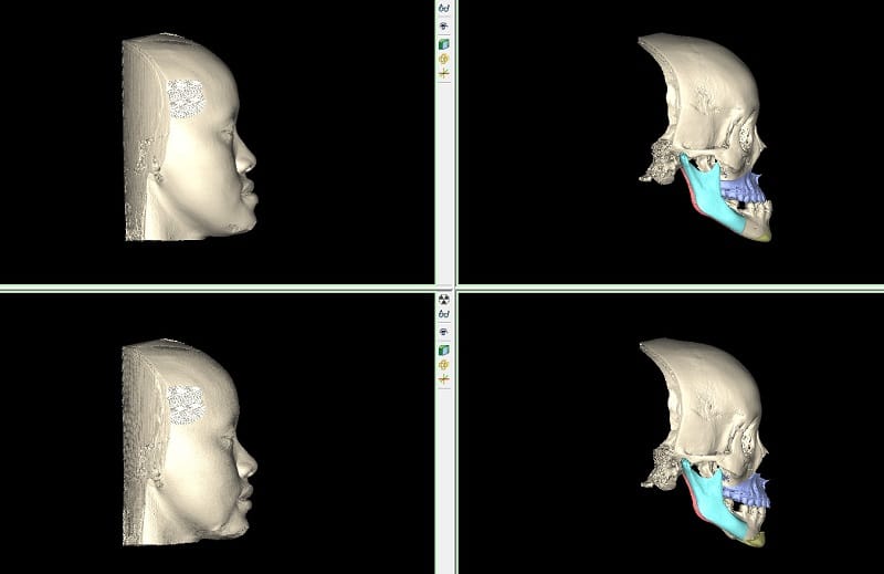 Ứng dụng công nghệ xem trước kết quả