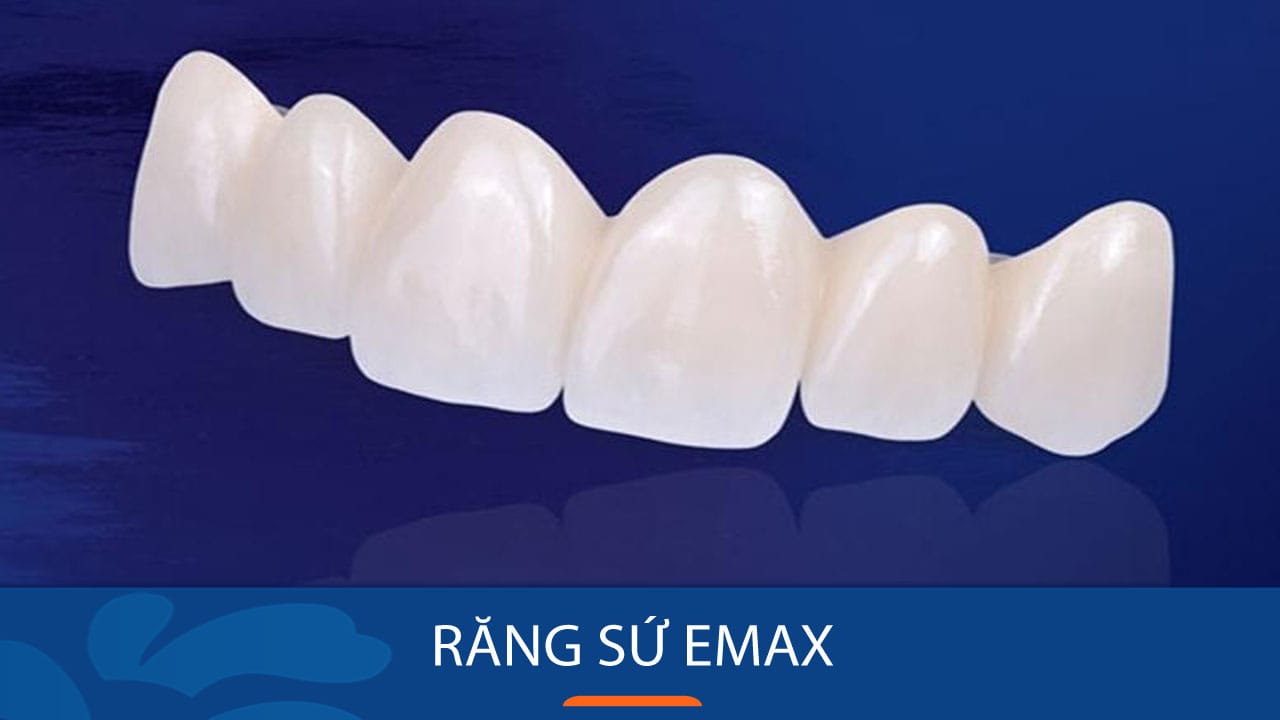 Địa chỉ làm Răng sứ Emax uy tín tại BV Kangnam
