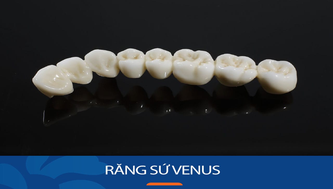Địa chỉ bọc Răng sứ Venus uy tín dành cho khách hàng việt kiều về nước