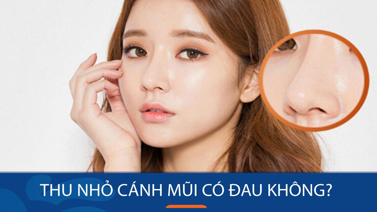 Thu nhỏ cánh mũi có đau không? Cảm nhận từ KH việt kiều