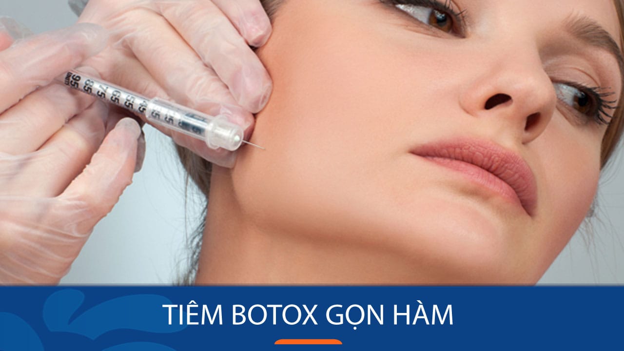 Tiêm gọn hàm cho khách hàng Việt Kiều về Việt Nam