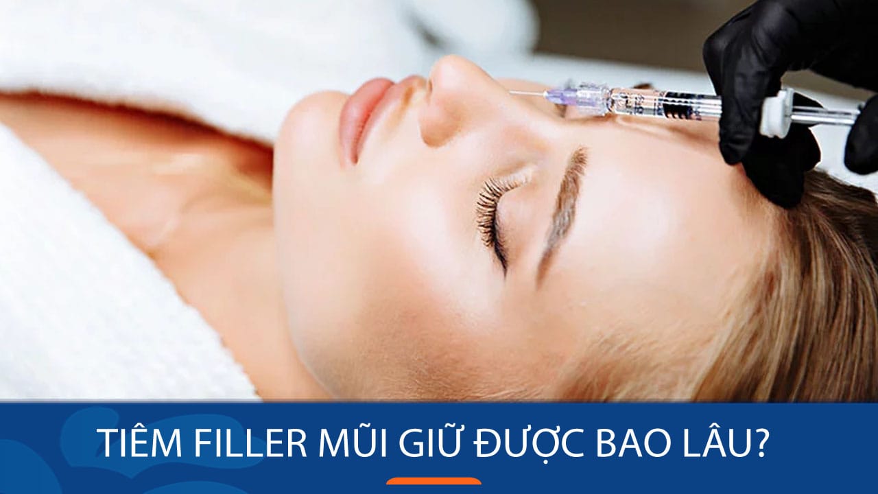 Tiêm filler mũi giữ được bao lâu? Bí quyết duy trì filler mũi