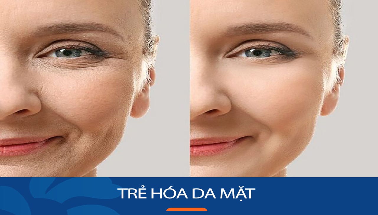 Trẻ hóa da mặt không xâm lấn dành riêng cho Khách hàng việt kiều