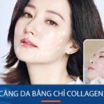 Căng da bằng chỉ collagen – Bí quyết sở hữu làn da không tuổi