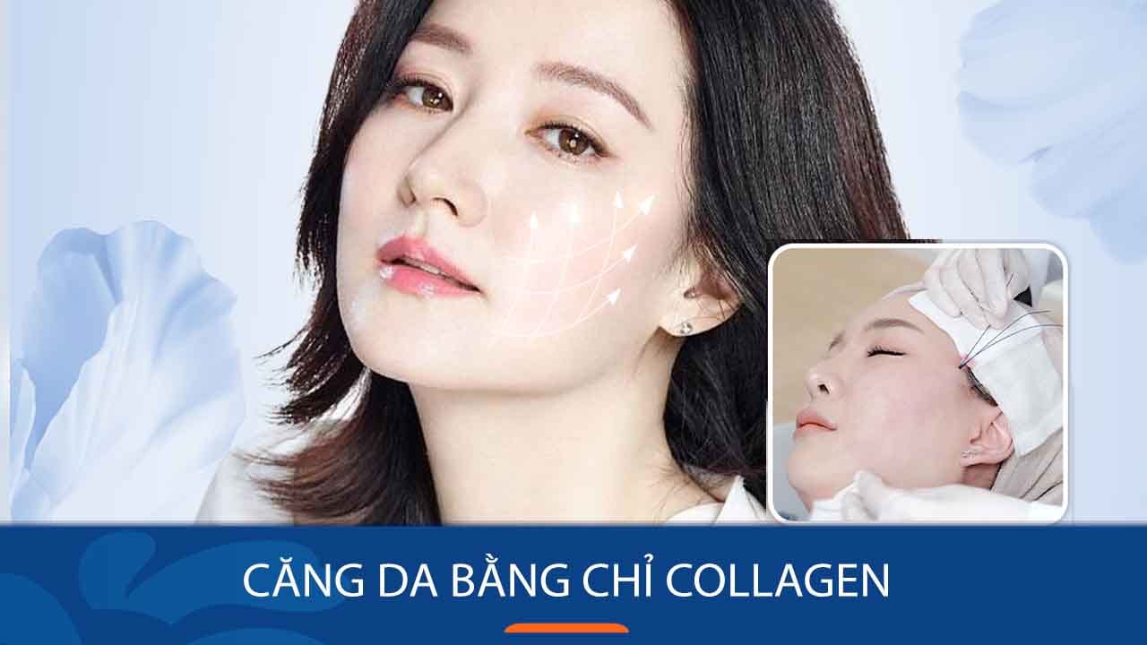 Căng da bằng chỉ collagen – Bí quyết sở hữu làn da không tuổi