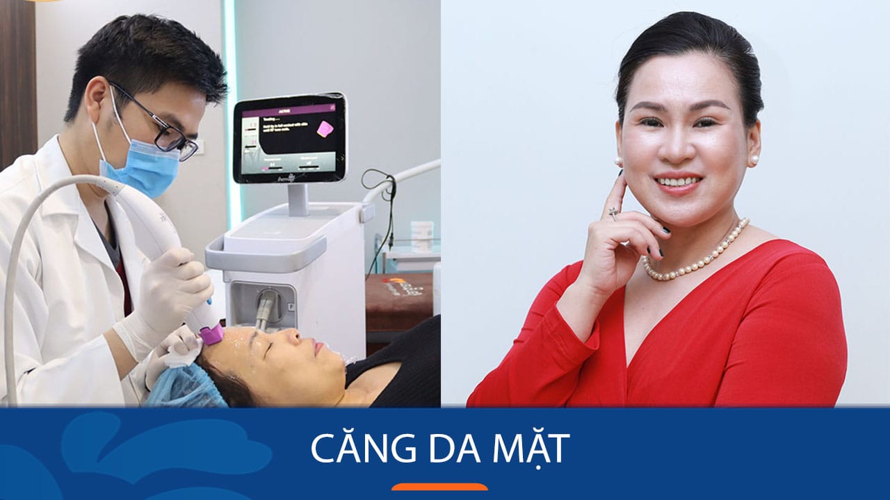 Căng da mặt – giải pháp trẻ hóa giúp lấy lại 10 năm tuổi xuân tươi trẻ