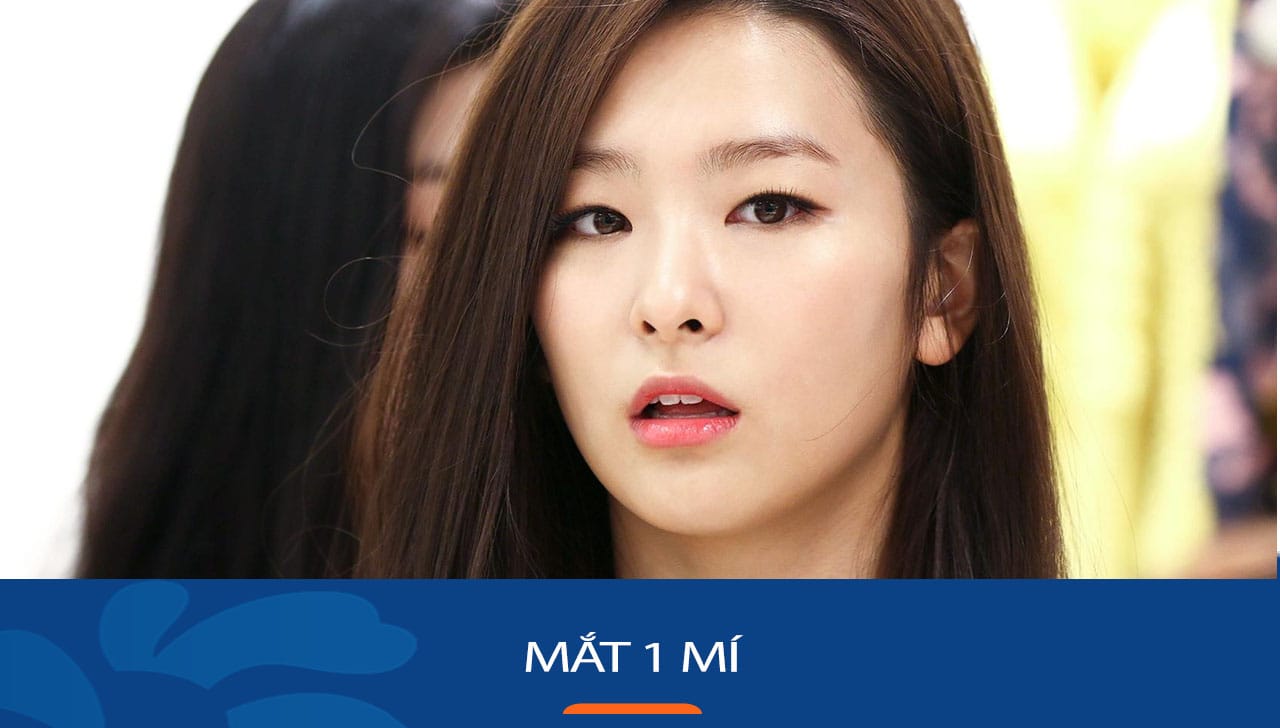 Mắt 1 mí là gì? Tổng hợp 3 công nghệ cắt mí tự nhiên tại Kangnam