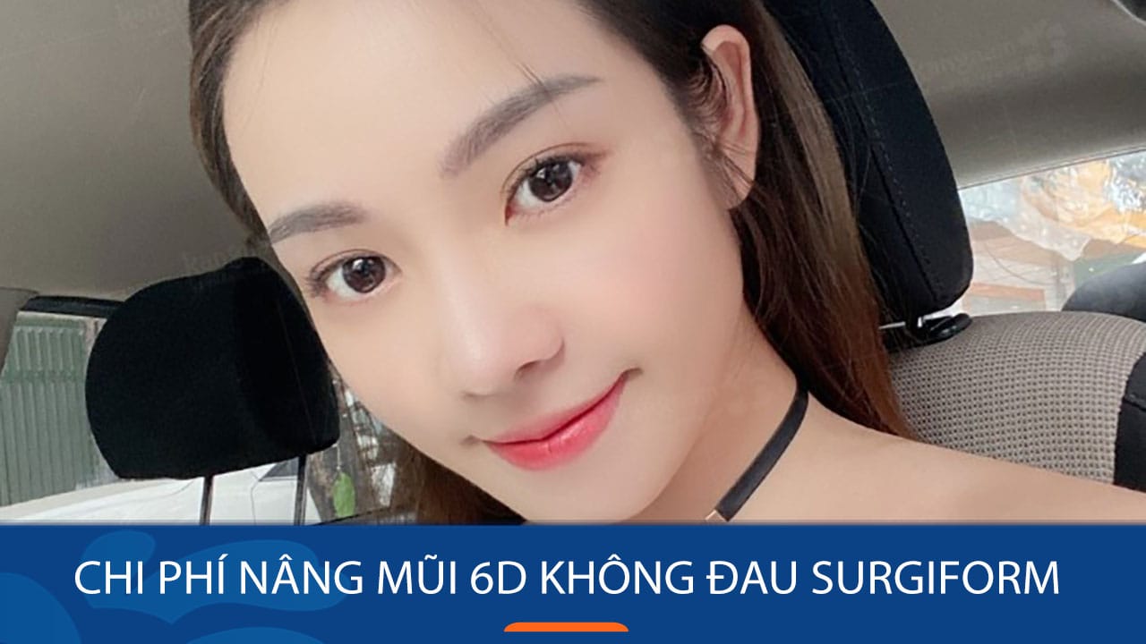 Chi phí nâng mũi 6D không đau Surgiform tại Kangnam? Bảng giá chi tiết