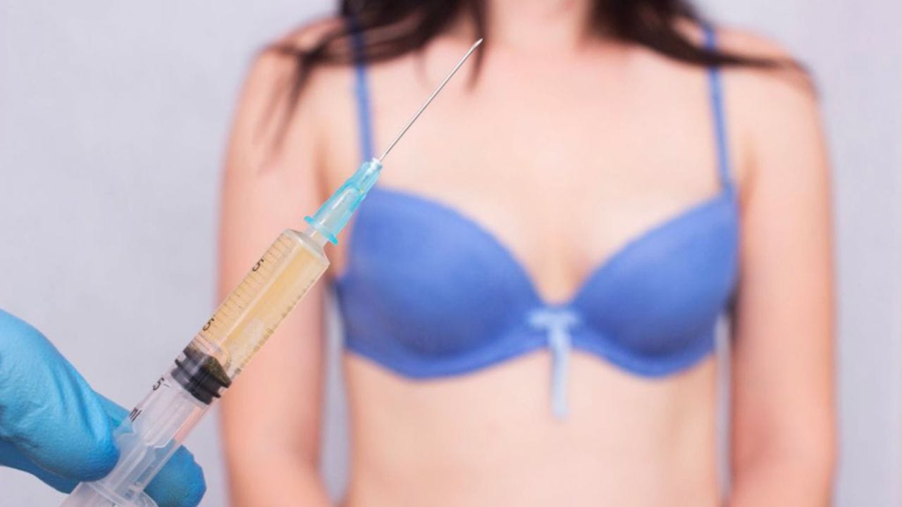 Nâng ngực không phẫu thuật: Ưu – nhược điểm chị em cần biết