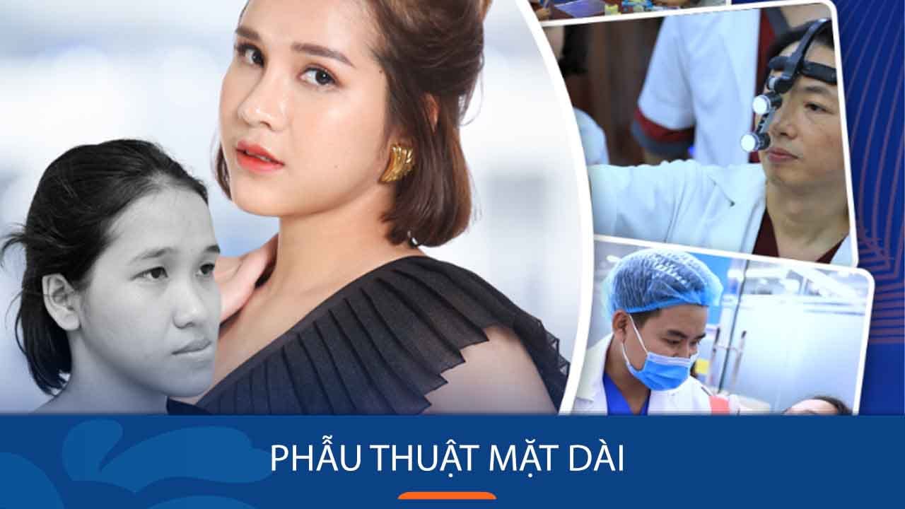 Phẫu thuật mặt dài – Giải pháp khắc phục tình trạng xương mặt biến dạng