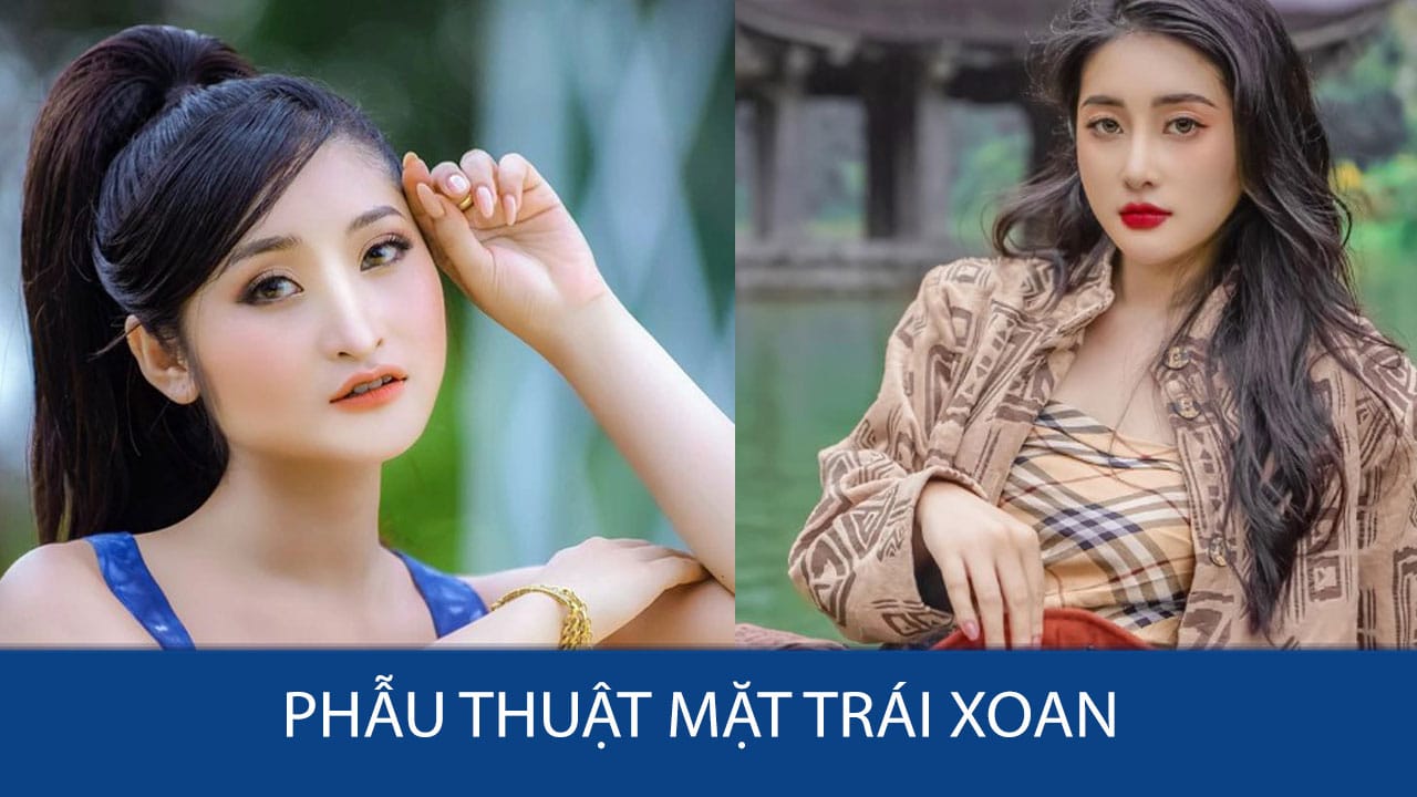 Phẫu thuật mặt trái xoan – Sở hữu gương mặt đẹp, thon gọn chuẩn Á Đông!