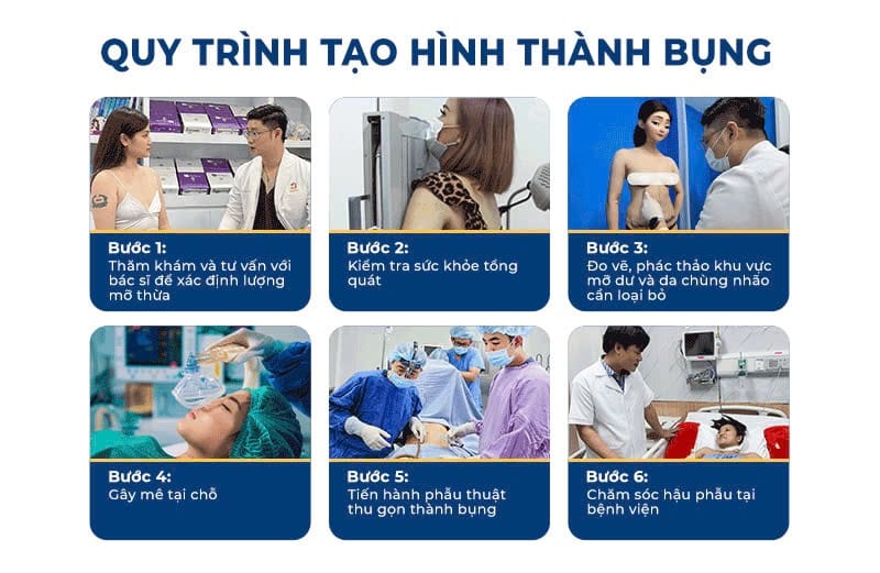 Quy trình tạo hình thành bụng tại Bệnh viện Thẩm mỹ Kangnam