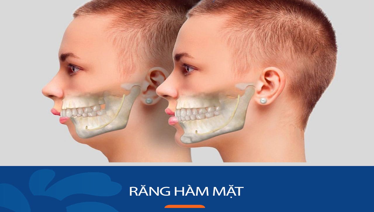 Phẫu thuật thẩm mỹ răng hàm mặt – Giải pháp tái tạo nhan sắc