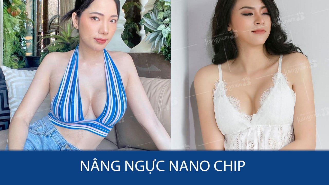 Nâng ngực Nano Chip – Giải pháp “nâng cấp” vòng 1 an toàn và đẹp tự nhiên!
