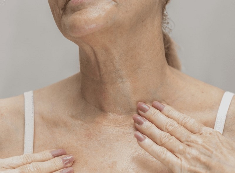 After a neck lift, the effect is maintained for a long time