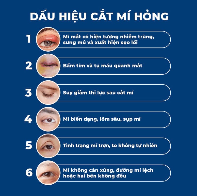 Các dấu hiệu cắt mí hỏng