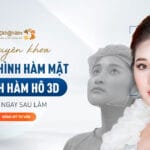 5 lý do nên chỉnh Hàm hô ngay tức khắc!