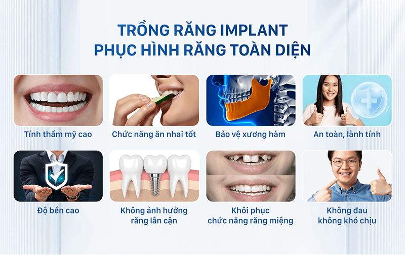 Ưu điểm khi thực hiện trồng răng Implant