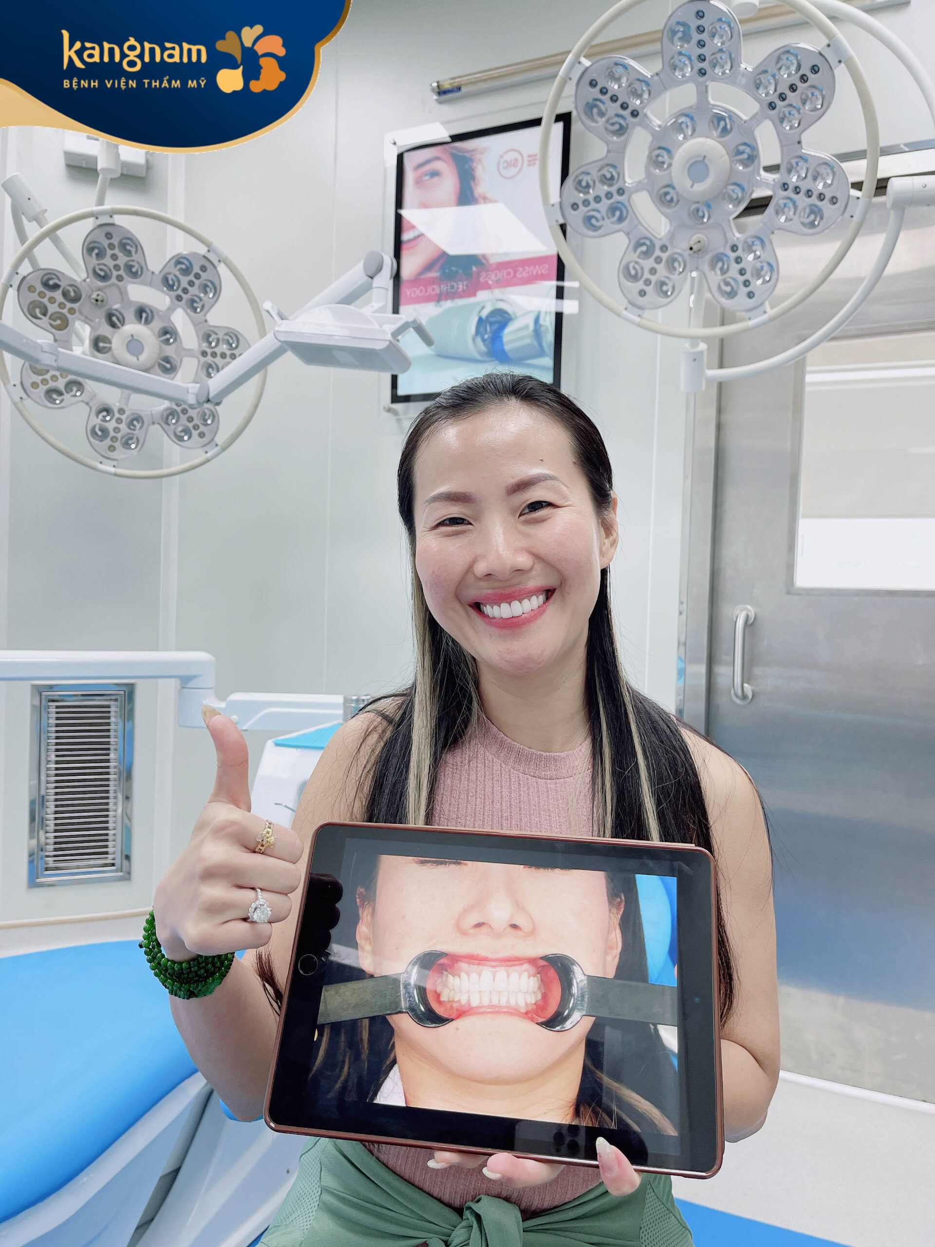 Đa số khách hàng đều hài lòng với hàm răng mới