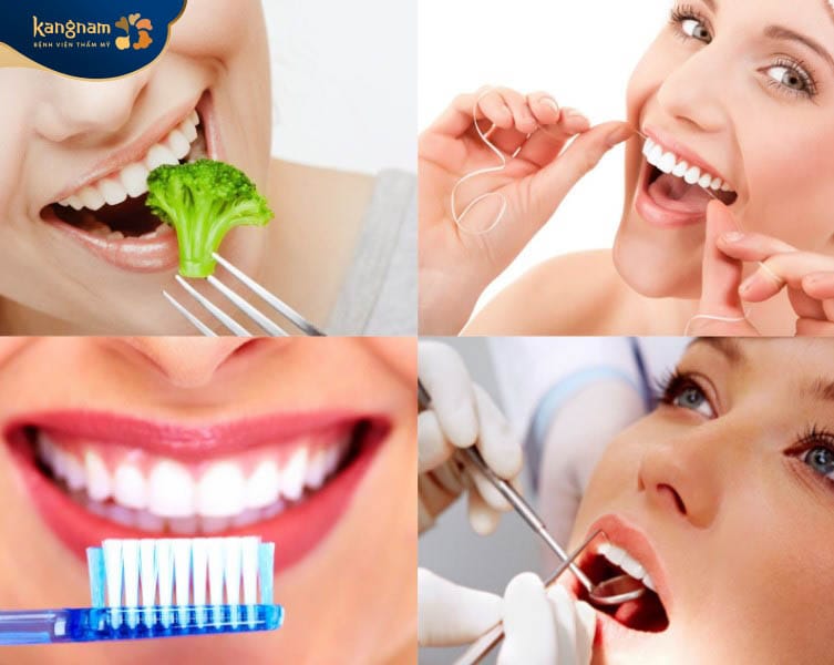 Chăm sóc và bảo vệ răng miệng sạch sẽ sau khi dán sứ