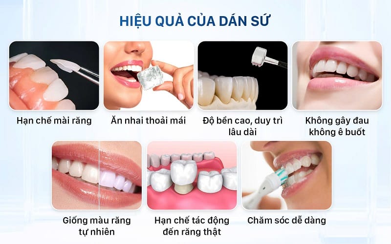 Dán sứ giúp hạn chế mài răng, cải thiện chức năng ăn nhai, duy trì hiệu quả lâu dài