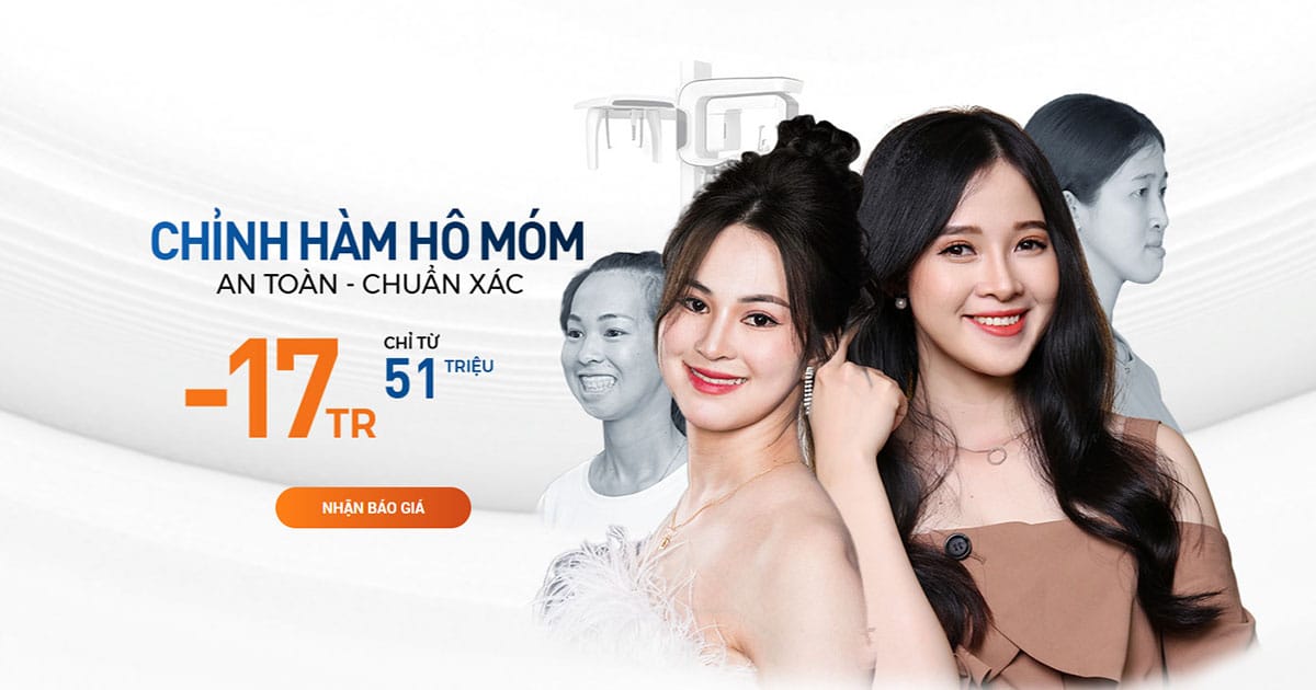 Chỉnh hàm hô móm 6D – Chạm trước kết quả