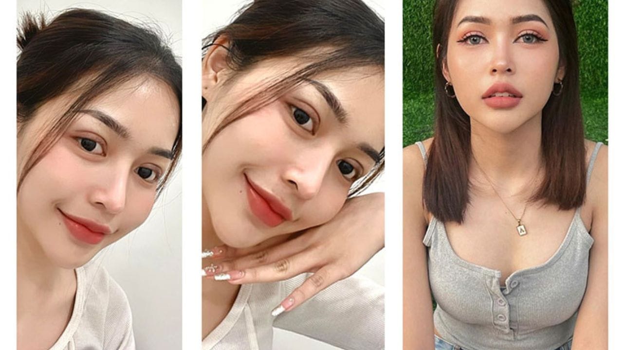 Hình ảnh cắt mí sau 1 tháng? cần lưu ý điều gì