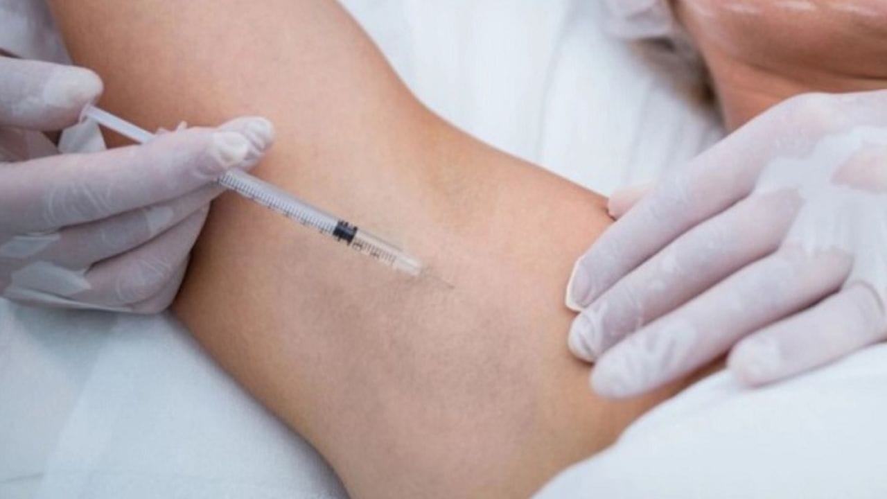 Tiêm botox trị hôi nách giá bao nhiêu?