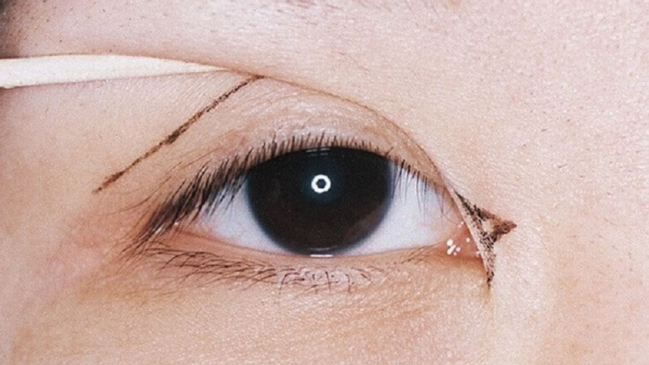 5 Tác hại của mở rộng góc mắt có thể bạn chưa biết