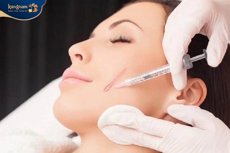 Tiêm corticosteroid để ức chế sự phát triển của sẹo lồi