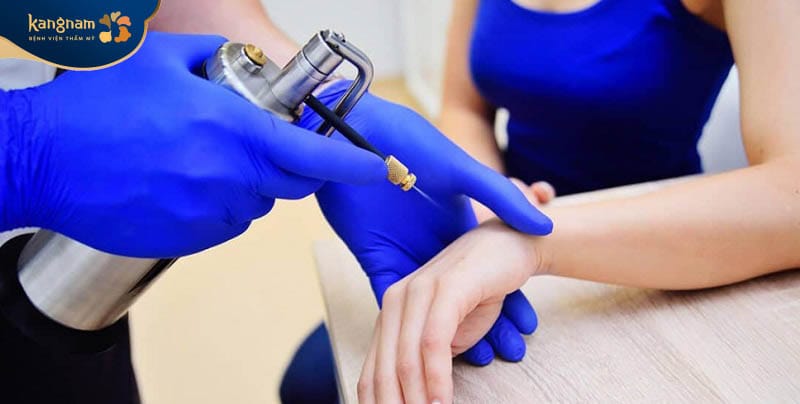 Sử dụng nhiệt độ thấp để phá hủy sẹo lồi