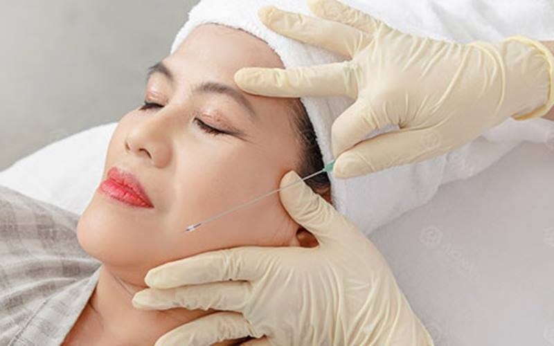 Loại chỉ chất lượng cao sẽ có chi phí cao hơn