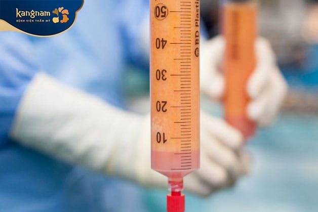 Chăm sóc tốt giúp mỡ sau khi cấy duy trì lâu dài