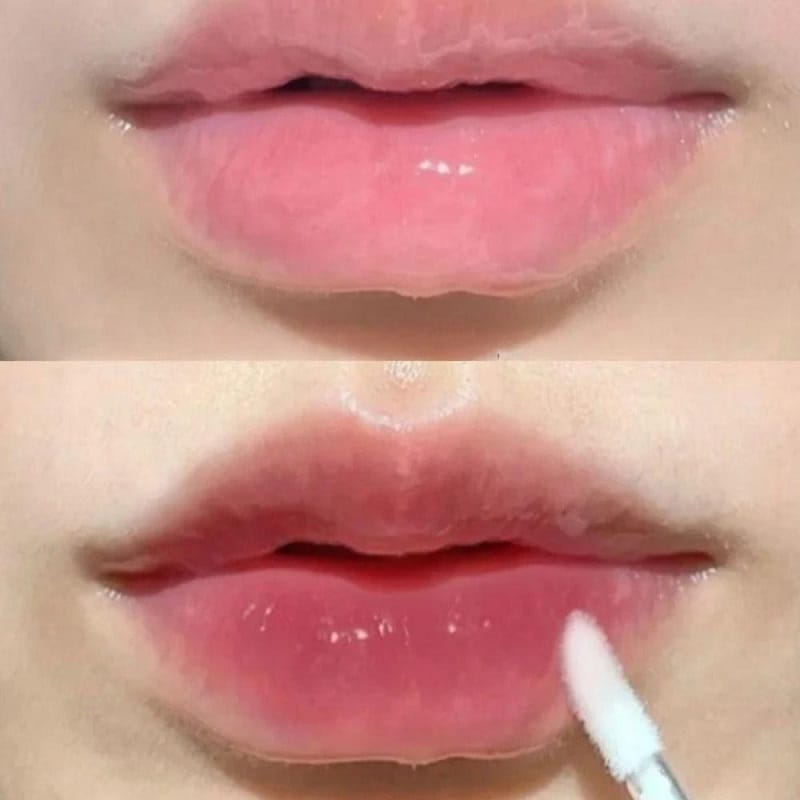 Dáng môi tiêm filler thuyền đắm mang lại sự quyến rũ, phóng khoáng