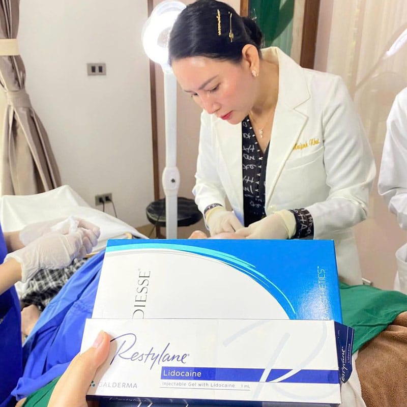 Filler có độ liên kết cao mất nhiều thời gian hơn để ổn định và vào form