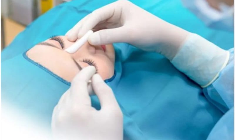 Duy trì độ bền lâu dài sau khi nâng mũi, chi phí thường đã trọn gói