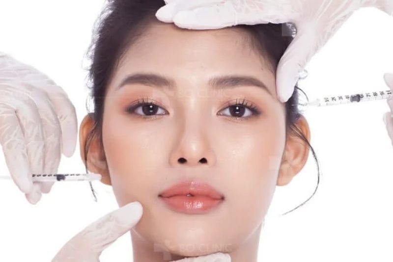 Muốn duy trì kết quả lâu dài cần tiêm filler định kỳ