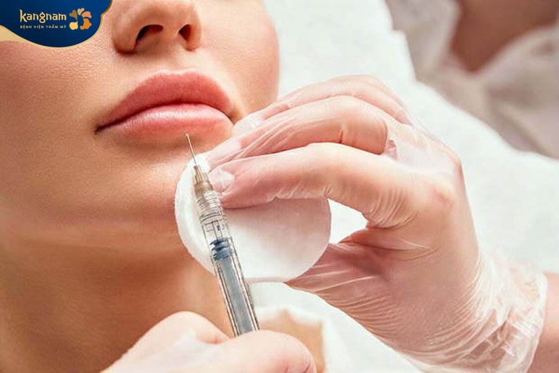 Sau tiêm filler nên chăm sóc vết thương cẩn thận