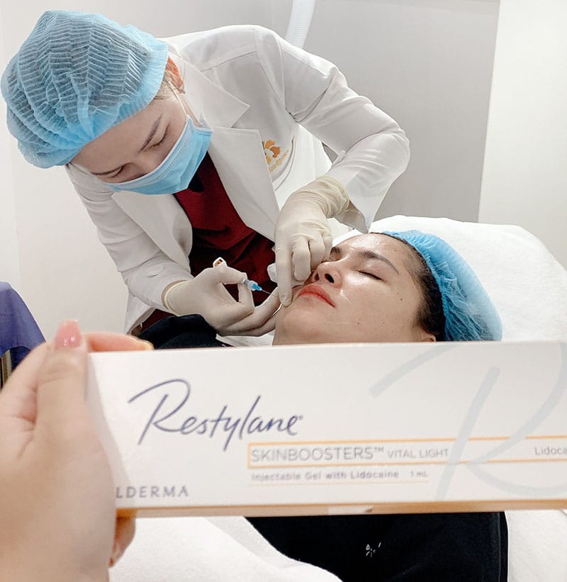 Filler cao cấp thường duy trì kết quả lâu hơn