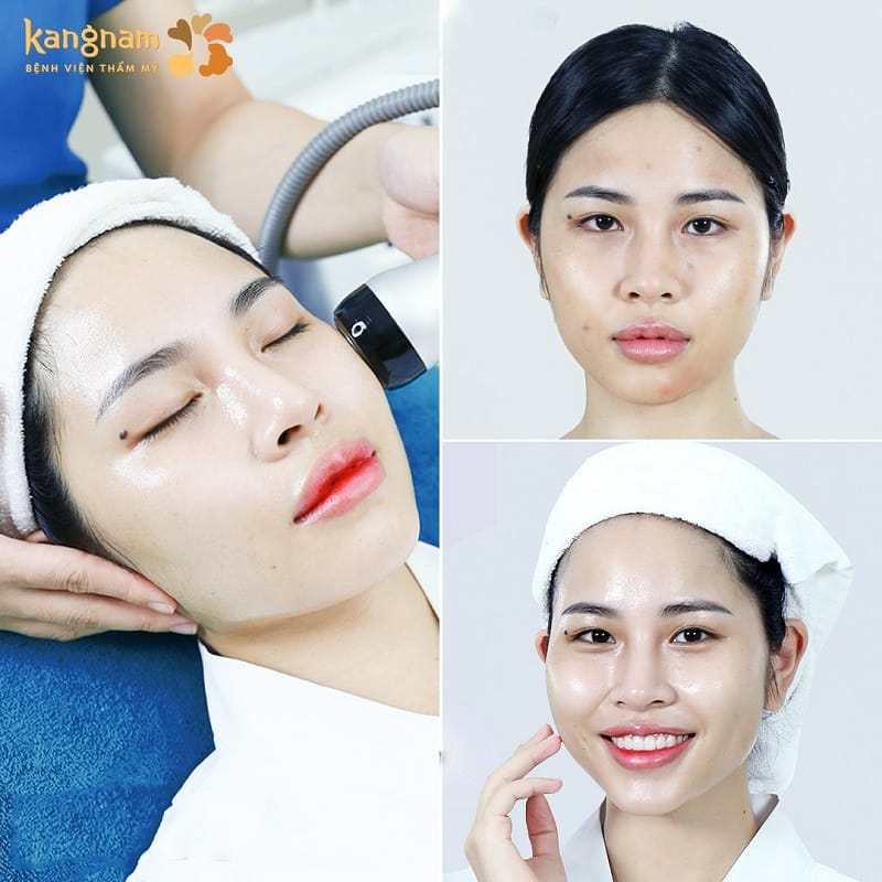 Sử dụng tinh chất cao cấp giúp da căng bóng, mịn màng tức thì