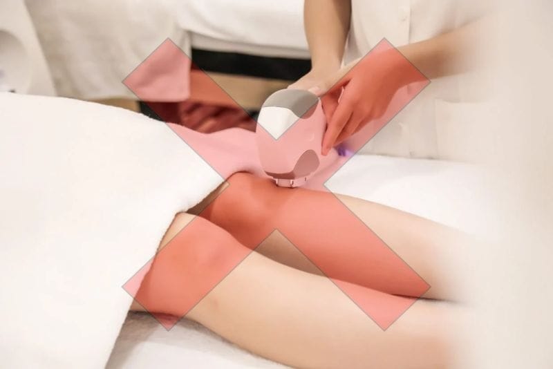 Trẻ 13 tuổi không nên triệt lông quá sớm