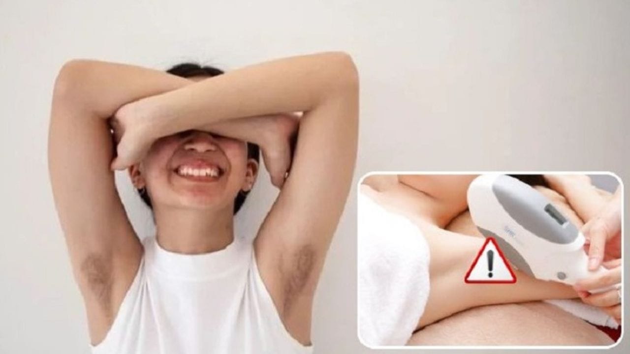 13 tuổi triệt lông được không? Những phương pháp tẩy lông phù hợp