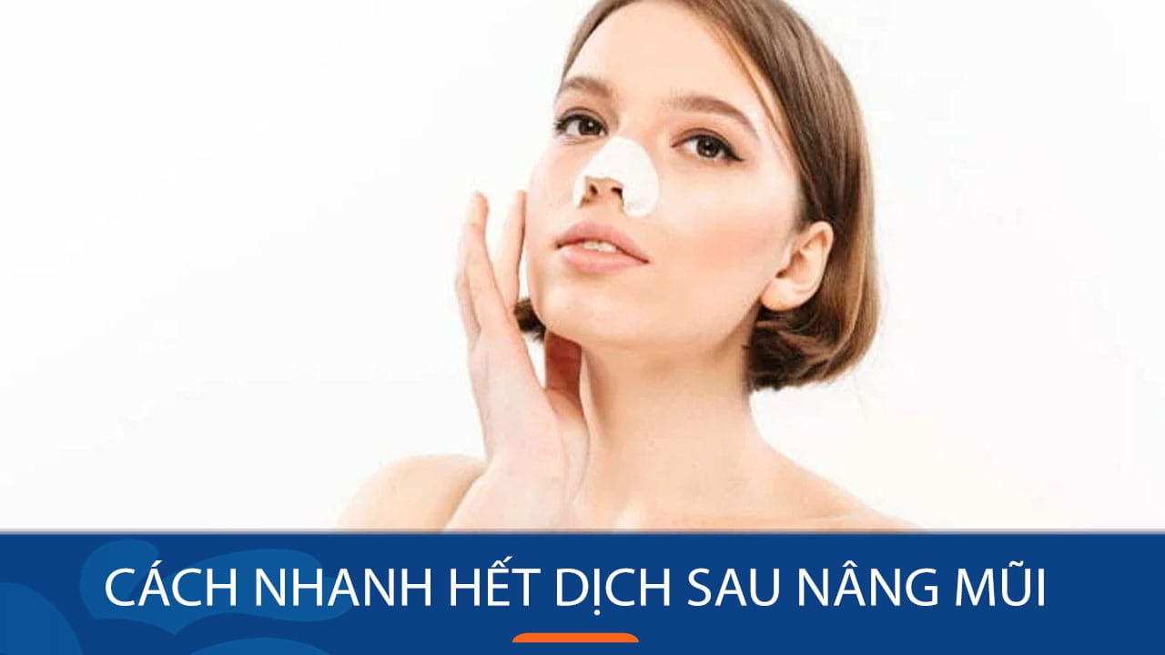 7 Cách nhanh hết dịch sau nâng mũi hiệu quả