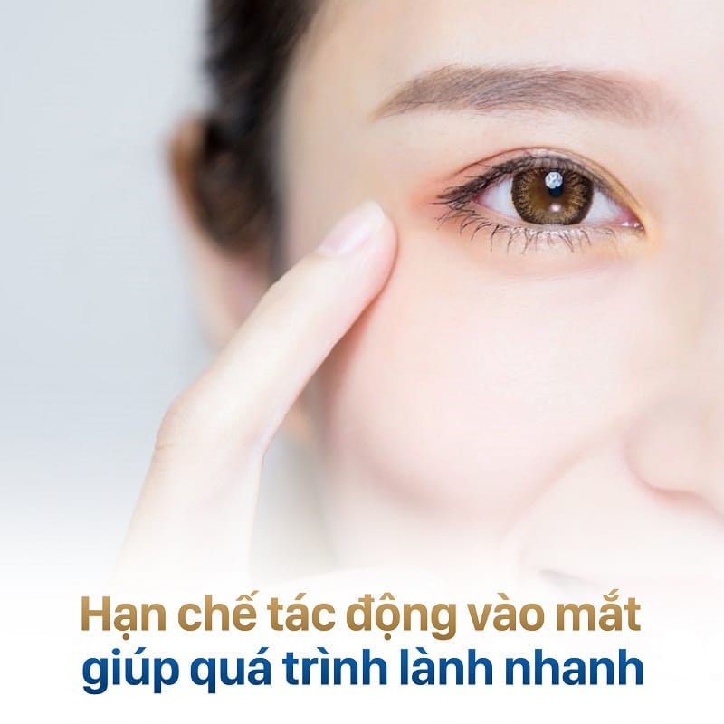 Tránh tác động mạnh vào vùng mí mắt 
