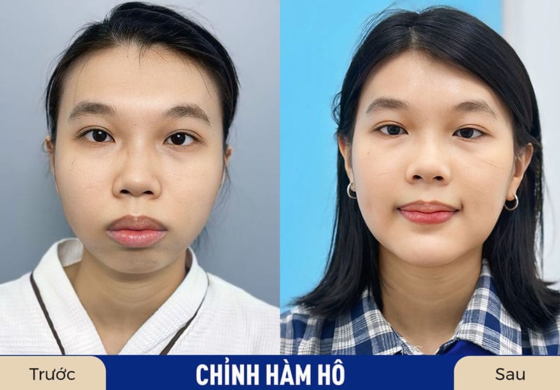 Kangnam có chính sách bảo hành dài hạn cho khách hàng