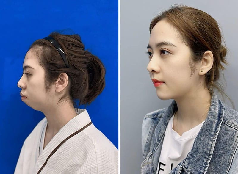 Bệnh viện Thẩm mỹ Kangnam