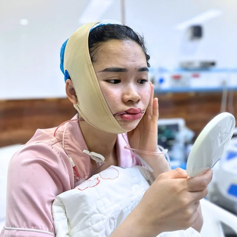 Jaw contouring causes mild swelling and pain for 2–3 days. 