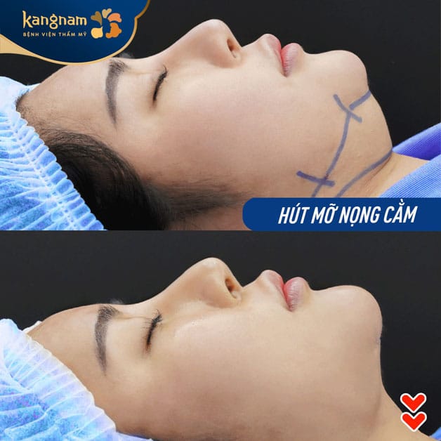 Khách Việt kiều được ưu tiên sắp xếp thời gian