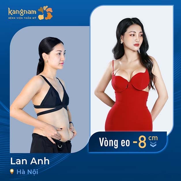 Thân hình chữ S quyến rũ sau giảm mỡ